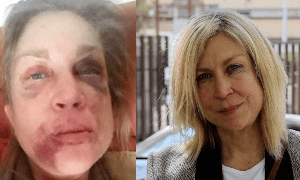 Linda Moberg, massacrata di botte dal marito nel 2019.