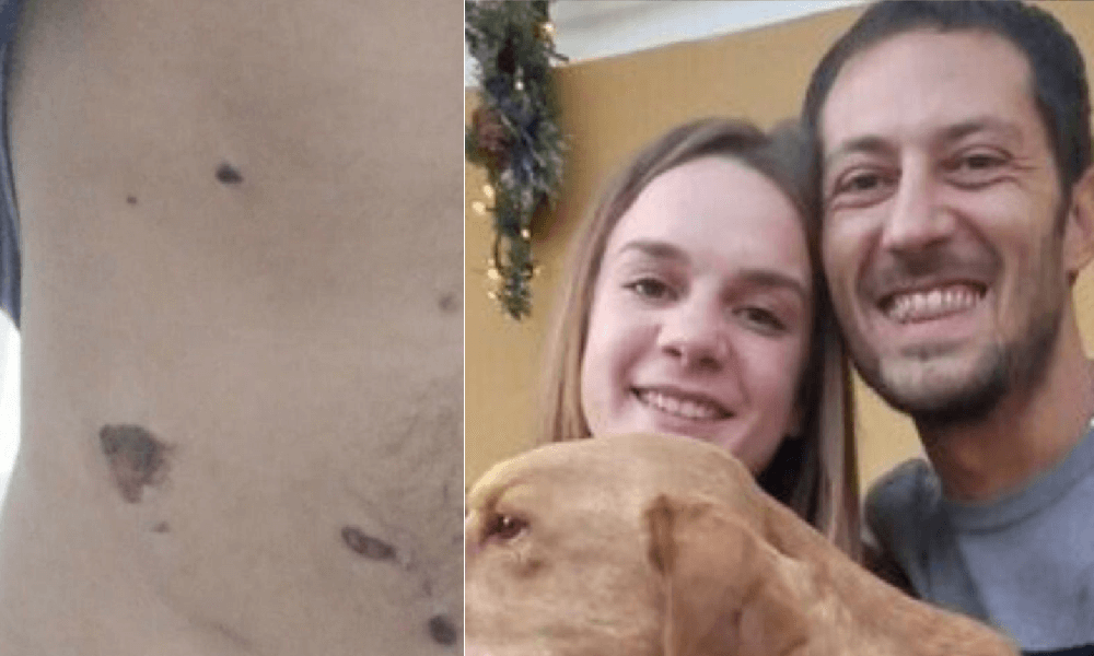 Aggredito da un'orsa come Andrea Papi, Antonio Vi amo, aiutatemi vi prego