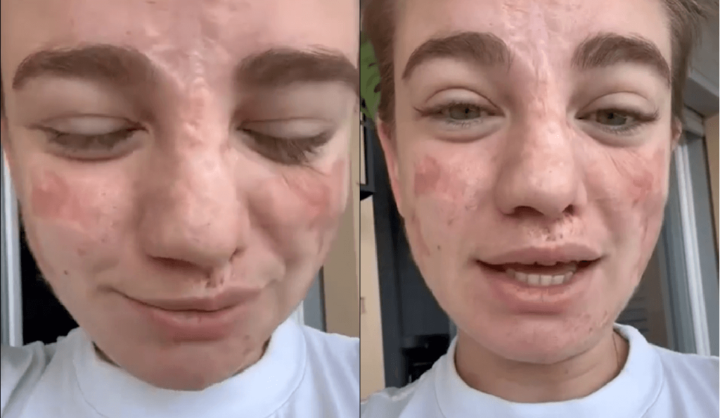 Bebe Vio derubata della borsa, il disperato VIDEO sfogo sui social: "Tenete tutto, ma ridatemi la tesi di laurea"