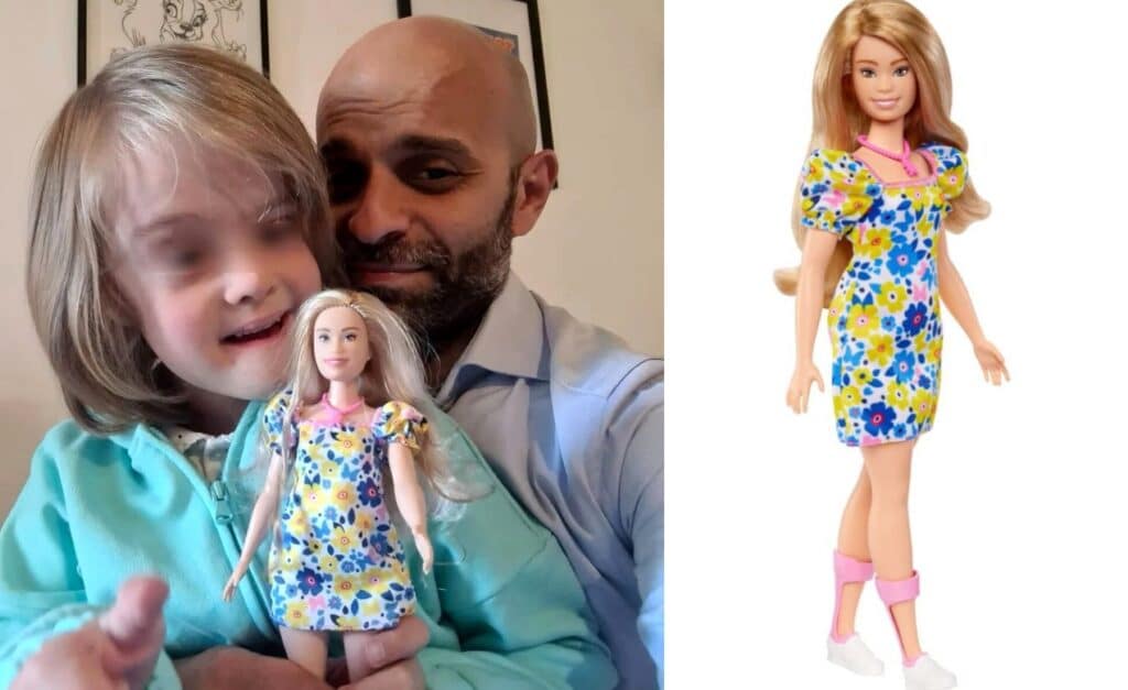 Barbie diventa sempre più inclusiva: in arrivo la bambola con sindrome di Down