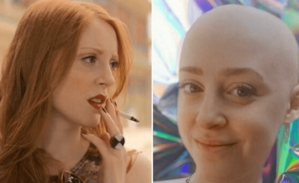 Morta Samantha Weinstein a 28 anni l'attrice ha perso la battaglia contro il cancro, la storia della giovane vittima