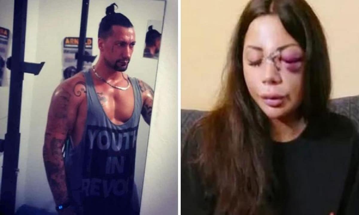 Prato, Martina sfregiata dall'ex