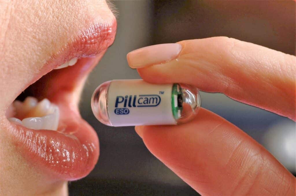 Scoperta medico scientifica nella capitale tramite l'utilizzo di una video pasticca per l'esame esofago-gastro-duodenoscopia-EGD