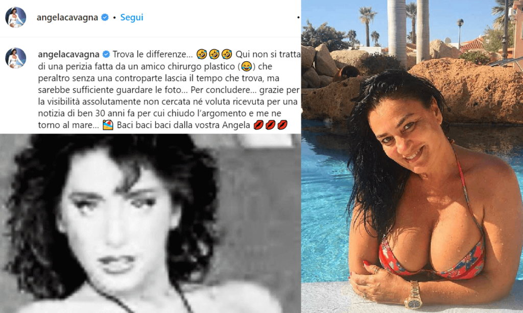Angela Cavagna ribatte alla Salerno (FOTO) Eccola la verità, altro che perizia di un amico chirurgo, l'ex modella incalza la polemica