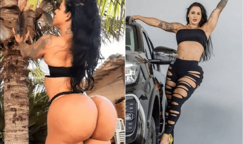 Modella brasiliana di 37 anni Voglio il lato B più grande al mondo ma non riesco più a sedermi dal dolore