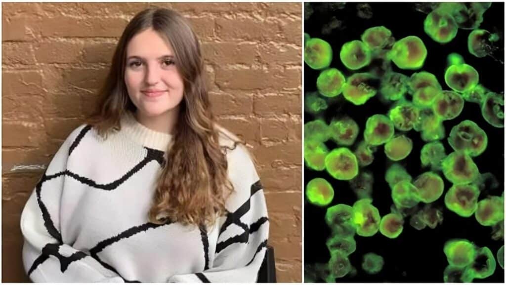 17enne uccisa da un’ameba mangia-cervello che l'ha infettata in un lago.