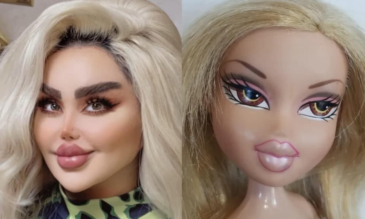 Subisce 43 interventi chirurgici per assomigliare a Barbie ma il risultato finale lascia a desiderare.