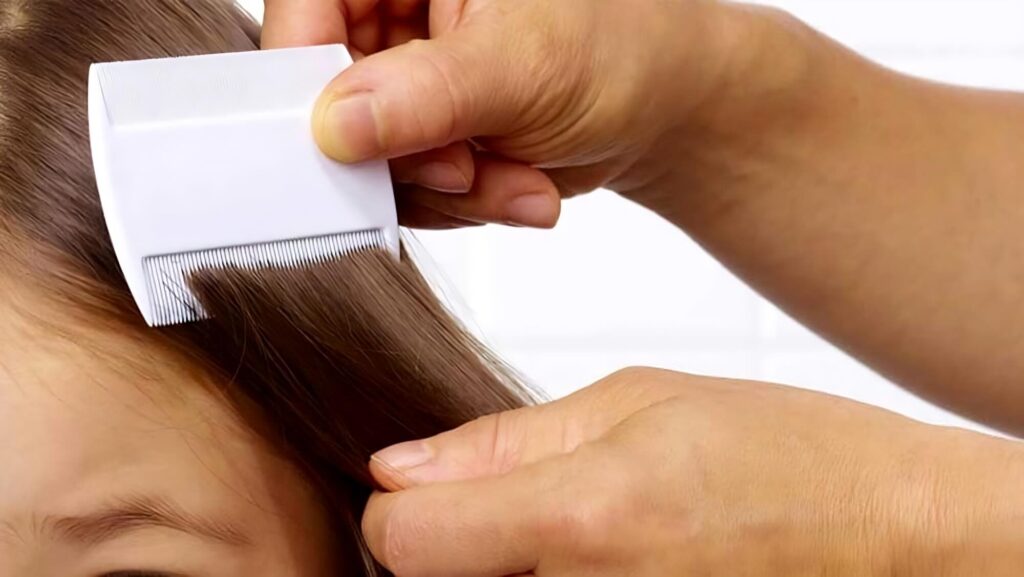 Mamma vegana si rifiuta di uccidere i pidocchi