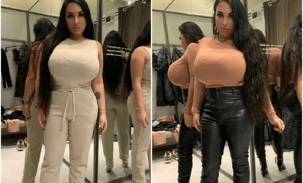 "La mia vita è un inferno per colpa del mio seno" (FOTO): i disagi di Anastasiya, l'intervista