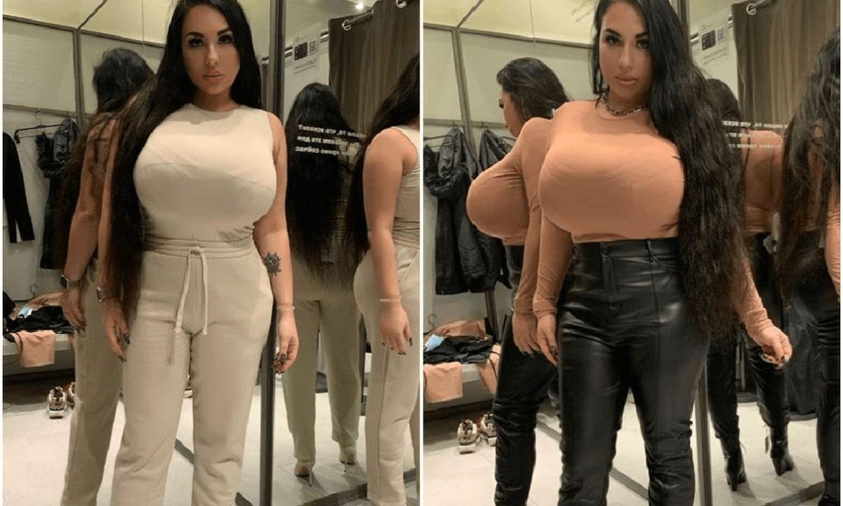 "La mia vita è un inferno per colpa del mio seno" (FOTO): i disagi di Anastasiya, l'intervista