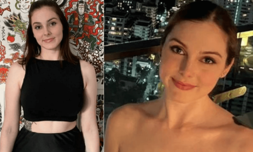 Mi dicono 'sei bella', ma quando mi giro mi rifiutano tutti (FOTO) il dramma di Alessandra, la sua storia