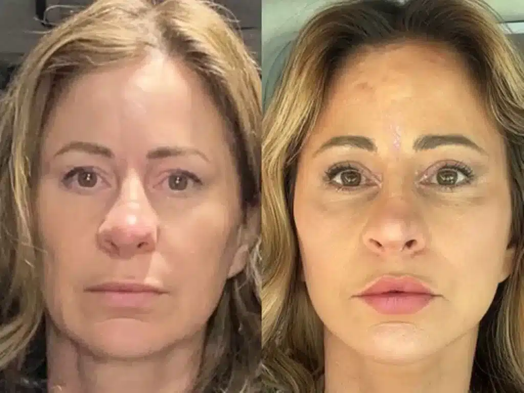 La donna riferisce di non avere alcun rimpianto e di essere felice con "20 anni in meno" in giro, col suo camper