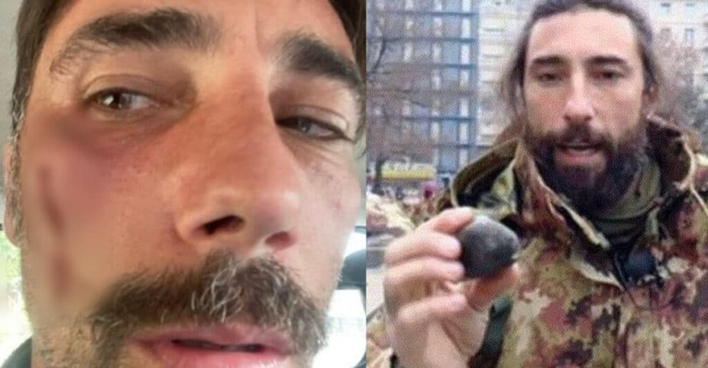 Vittorio Brumotti di Striscia la Notizia, aggredito 2 volte dagli spacciatori a Milano e Mestre