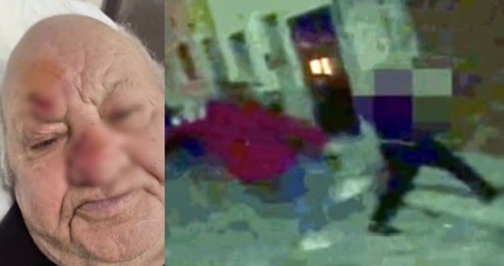 88enne aggredito da una babygang a Secondigliano