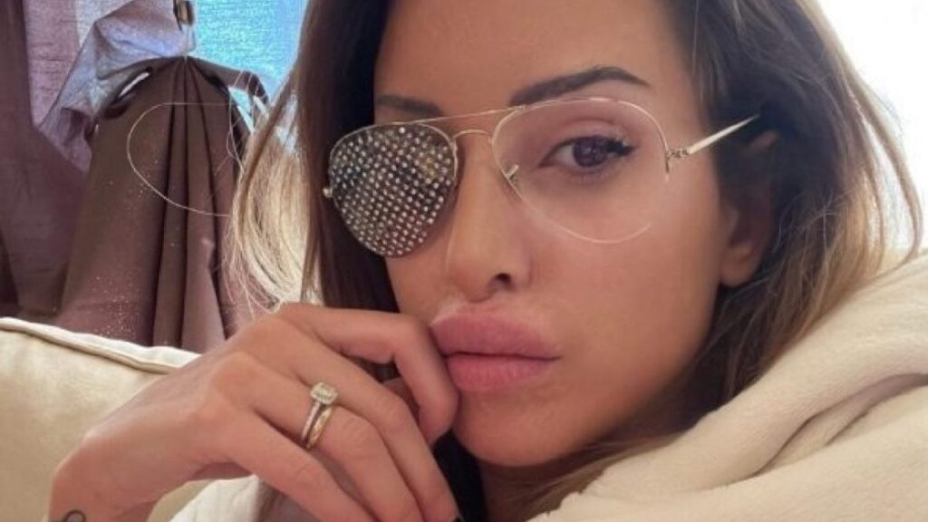 L'attivista riminese nel 2017 fu sfregiata con l'acido sul volto dall'ex compagno