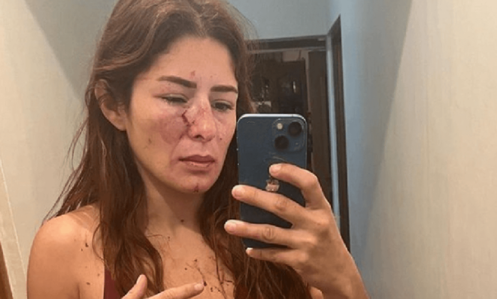 Lottatrice professionista massacrata dal marito davanti alla figlia di 4 anni