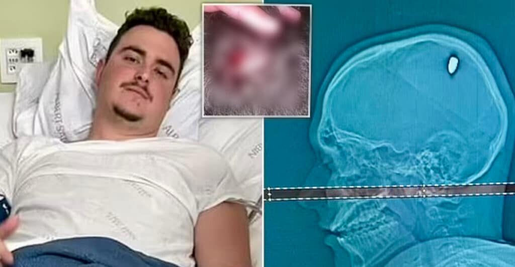 21enne proiettile nel cervello dopo una festa