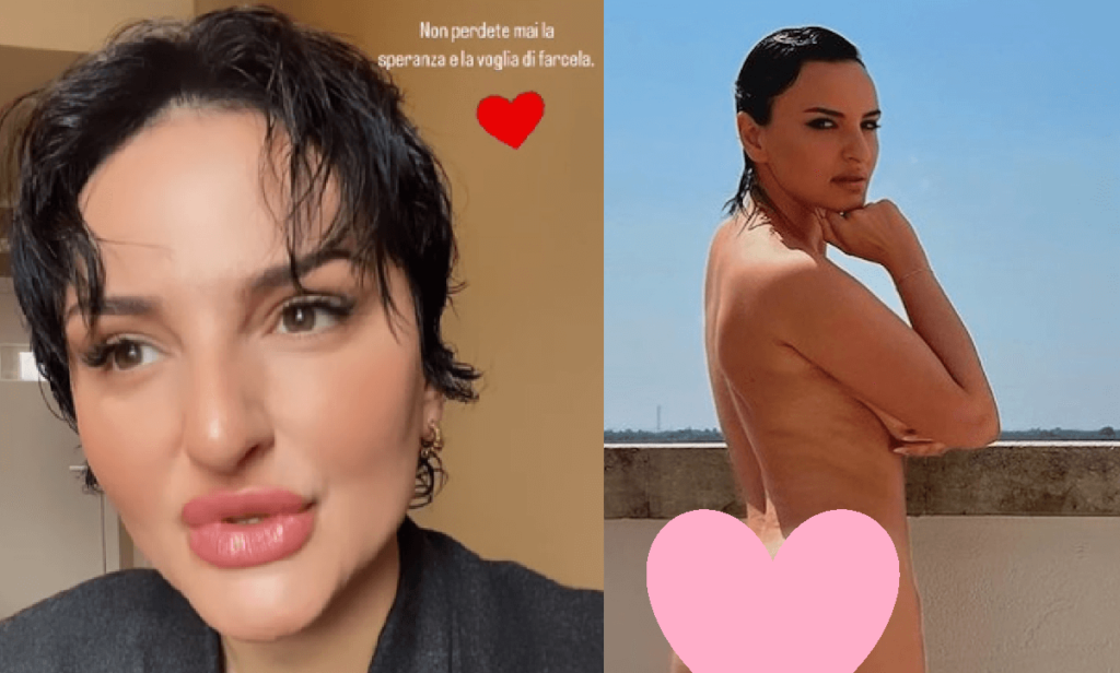 Il cambiamento di Arisa le FOTO dei ritocchini Ho fatto punturine, le ultime sull'artista