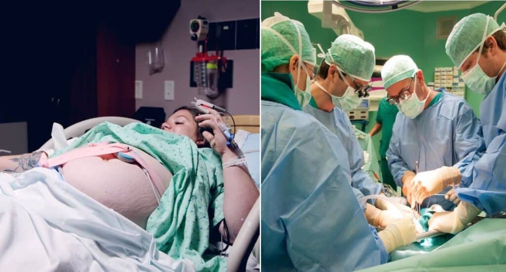 Mamma si lacera il fegato durante il parto: salvata dai medici di Torino