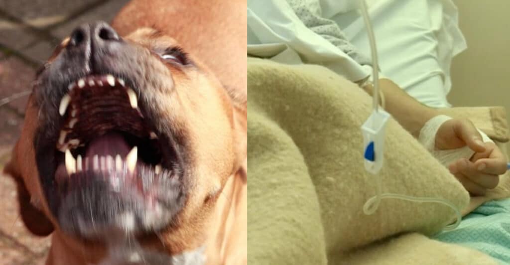 Donna incinta azzannata da un pittbull: "Mi ha rovinato la vita"