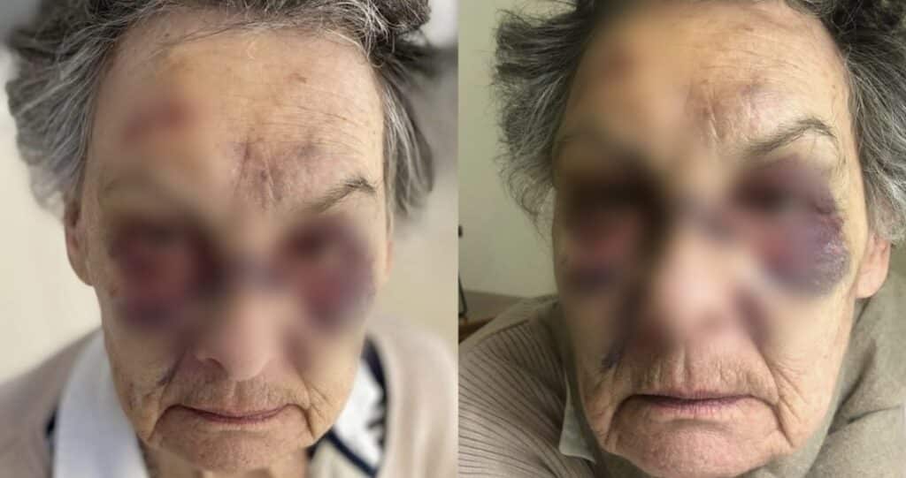 83enne picchiata da un senzatetto a Milano