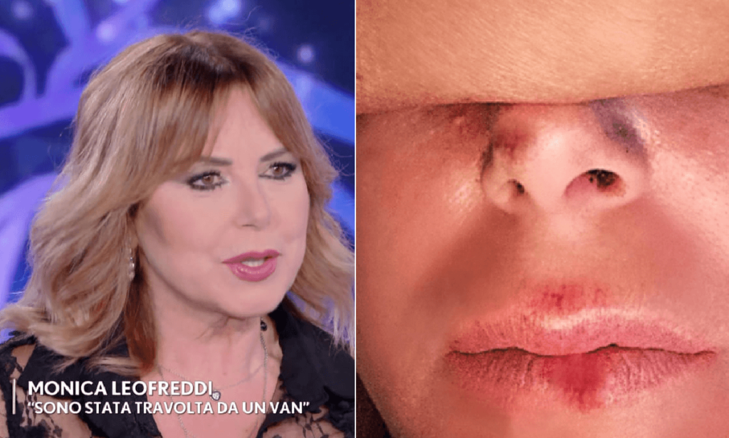 Monica Leofreddi choc Sono stata investita e poi umiliata, non ho denunciato