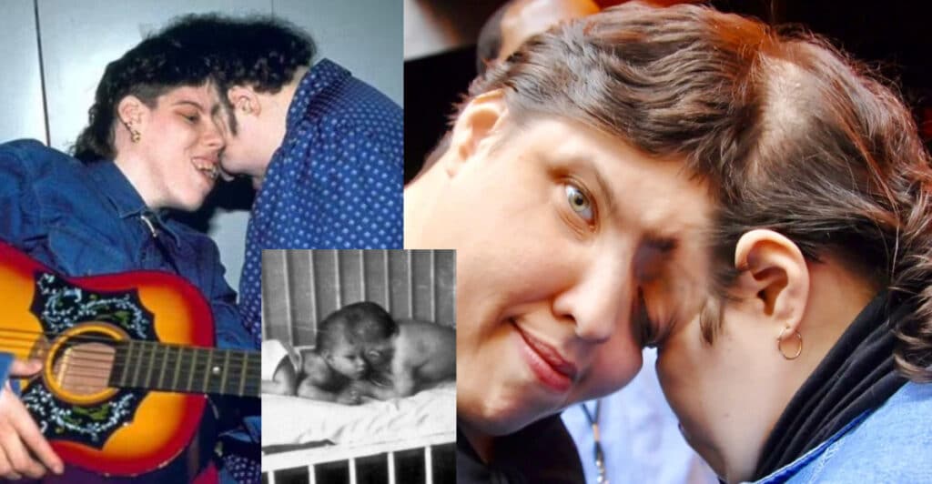 Lori e George: morti i più anziani gemelli siamesi del mondo