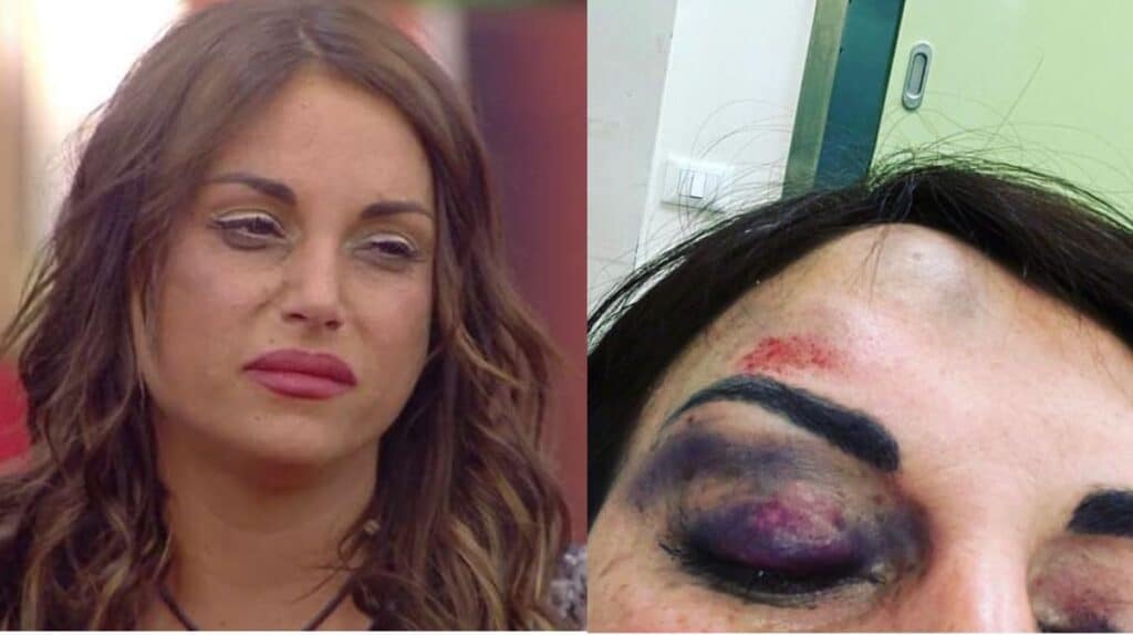 Francesca De André vittima di violenza