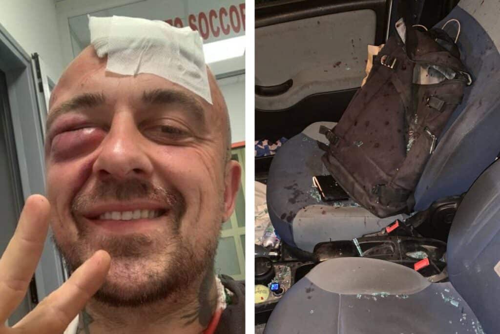 "Mi hanno aspettato fuori casa in 5 e hanno tagliato i fili del cancello per massacrarmi." Ha detto nel video Gabriele Rubini, in arte Chef Rubio. Come sta