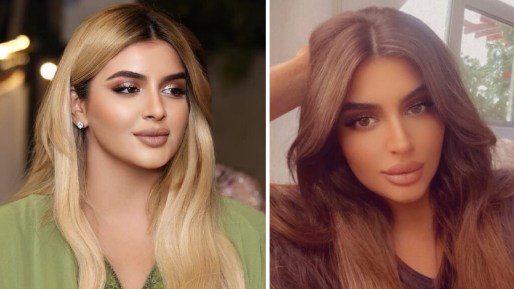 Un post e via. Come togliere un cerotto. Il suo matrimonio, avvenuto solo tre mesi fa, è solo un lontano ricordo.