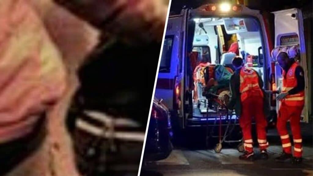 stacca dito morsi accoltella lite