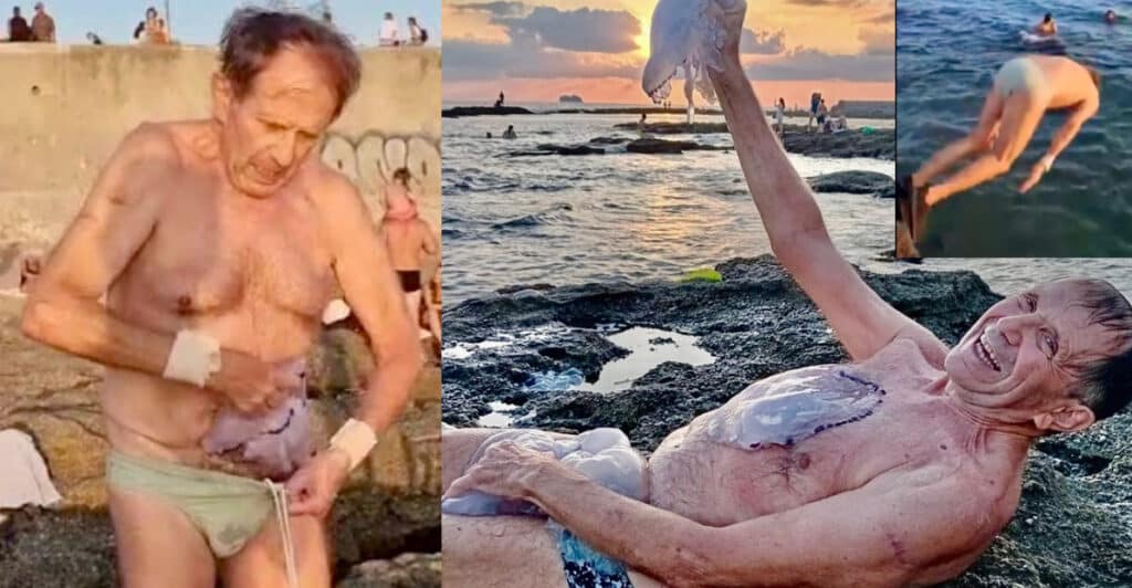 Alberto, infila una medusa nelle mutande e si tuffa in mare