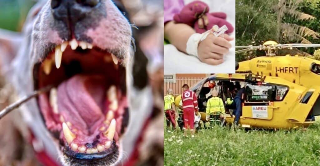 Bimba di 11 mesi azzannata da un Bull Terrier