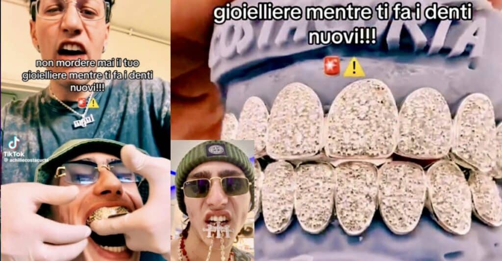 Achille Costacurta torna sui social con la dentiera di diamanti