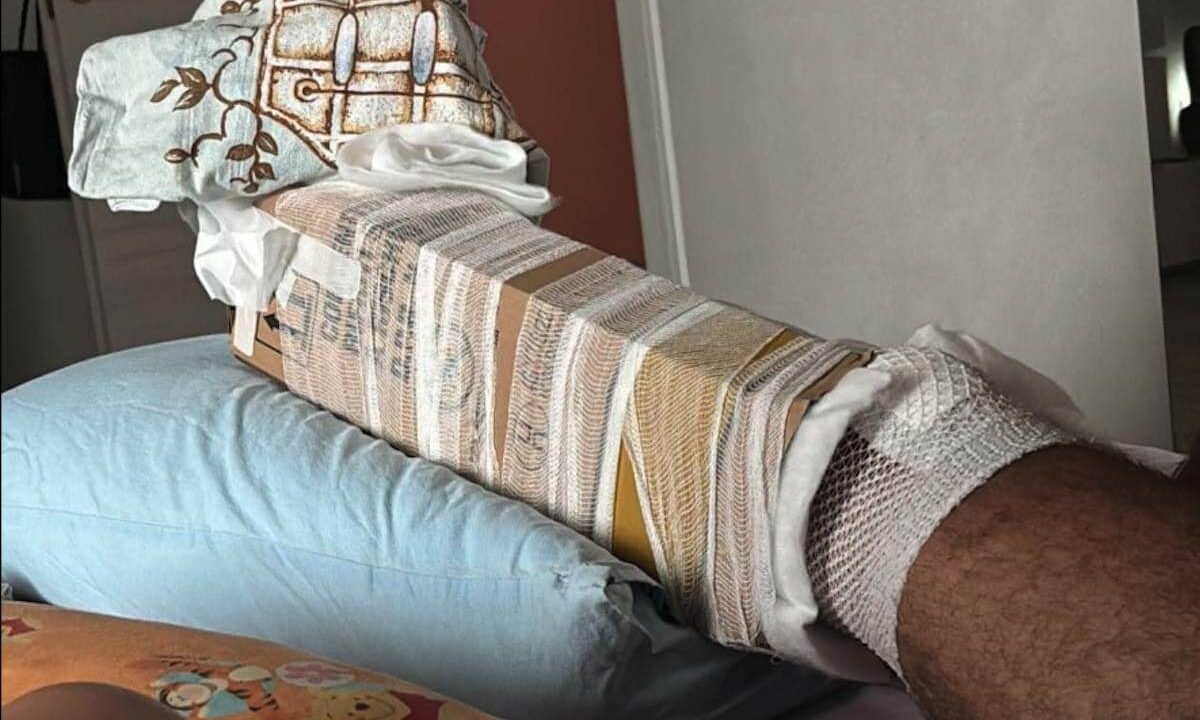 Patti, finiscono le stecche e bloccano la frattura con un cartone