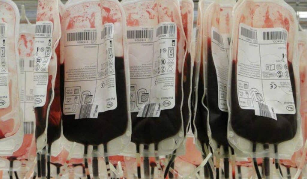 sbagliano sacca trasfusione muore 71enne