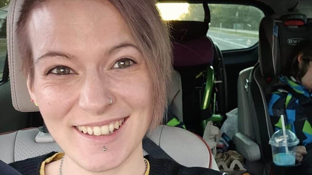 32enne scopre di avere la "malattia del vampiro": ecco cos'è