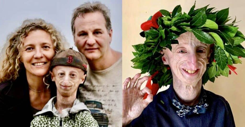 Morto a 28 anni Sammy Basso: l'addio dei genitori