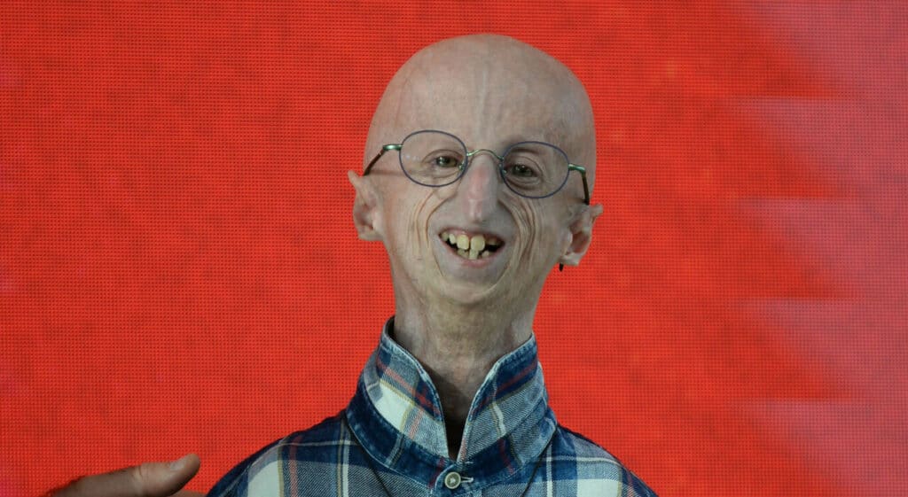 Morto Sammy Basso a 28 anni, colto da un malore in un ristorante